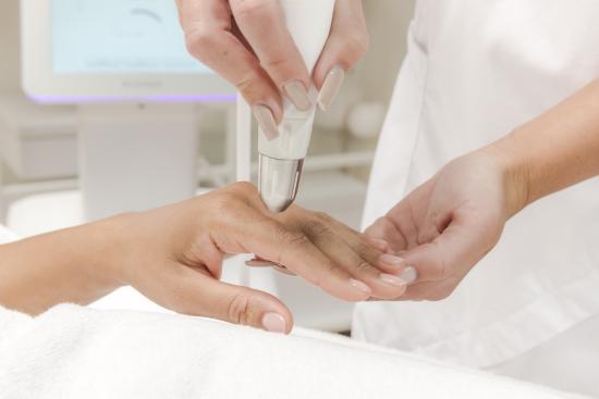 Dermadrop Behandlung Hand